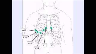 How To Complete Right Side ECG [upl. by Doolittle]