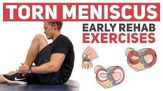 Meniscus Tear  Start With These Rehab Exercises [upl. by Eul]