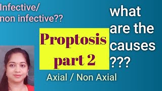 Classification and causes of Proptosis  Axial or non axial proptosis [upl. by Osugi966]