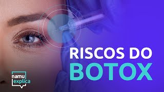 Riscos da aplicação de botox no rosto [upl. by Juni9]