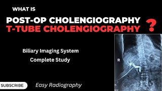 T Tube CholangiographyPost Operative CholangiographyXray Procedure In UrduHindiEasy Radiography [upl. by Pascha]