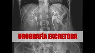 FLUORO DIA 5  UROGRAFIA EXCRETORA Y FISIOLOGIA DEL APARATO EXCRETOR [upl. by Rosie579]