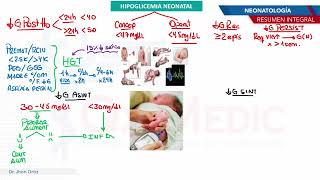 Neonatología  Hipoglicemia neonatal [upl. by Hermie561]