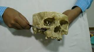 Base of the Skull Anatomical position demonstrated by Dr Zobayer Mahmud Khan [upl. by Lidda]