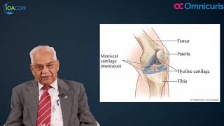 Osteoarthritis Hindi  IOACON 2017 [upl. by Kruter861]