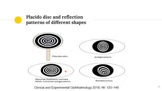 Understanding Corneal topography and Pentacam  Part I follow quickguideorg [upl. by Amanda]