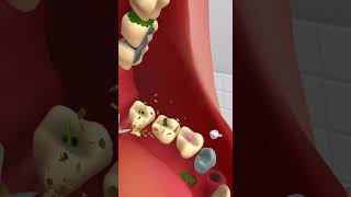 Teeth cavity removal ASMRasmr satisfying shorts viral [upl. by Terhune]