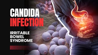 What is Candida Gut Infection  Explained [upl. by Elades]