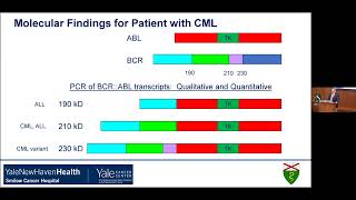 Yale Cancer Center Grand RoundsSturges Lecture in Hematology  June 7 2024 [upl. by Lebatsirhc]