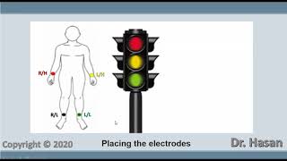 12 lead ECG placement of electrodes  procedure explained animation [upl. by Inaliak761]