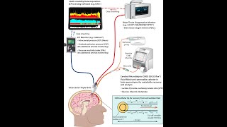 Cerebral microdialysis and brain tissue oxygenation  Dr Shruti Agrawal and Mr Ibrahim Jalloh [upl. by Clareta]