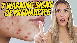 7 Early Warning Signs of Prediabetes You Cant Ignore [upl. by Einnalem526]