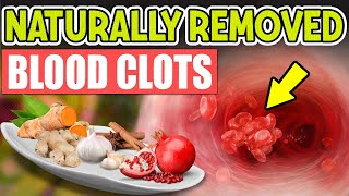 Top 10 Best Foods That Naturally Thin the Blood to Prevent Clots🍏🌶️🍵 [upl. by Anaujd]