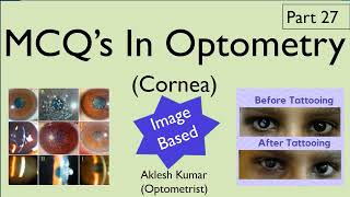 MCQ’s in Optometry  Cornea  Part 27 [upl. by Gustie447]