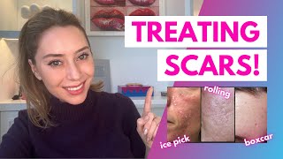 How To Treat Scars Flat Depressed Raised and Keloids  Dr Shereene Idriss [upl. by Noryv213]