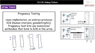 A Level Biology  5128  Kidney Failure [upl. by Ainoda]