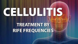 Cellulitis Bacterial infection  RIFE Frequencies Treatment  Energy amp Quantum Medicine [upl. by Alema]