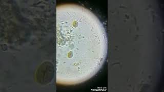 Giardia lamblia cyst [upl. by Shena]