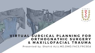 Virtual Surgical Planning for Orthognathic Surgery amp Maxillofacial Trauma [upl. by Ahseka]