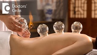 Is Cupping Therapy or Al Hijama painful  Dr Shagufta Siraj [upl. by Kwei973]