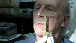 Dentures  Wax Rim Appointment  Wax esthetics speech CR VDO [upl. by Tegdig397]