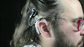 Dales journey with a cochlear implant [upl. by Grand715]