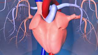 Implantable CardioverterDefibrillator ICD [upl. by Keryt989]