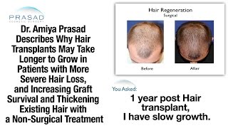 Why Some Hair Transplant Results Take Longer to Grow and Stimulating Hair Growth After a Transplant [upl. by Amelia]