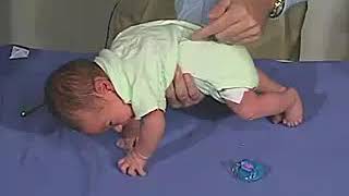 324  Primitve Reflexes Galant Reflex  Newborn Normal  Infant Clinical ExaminationMRCP [upl. by Eustazio]