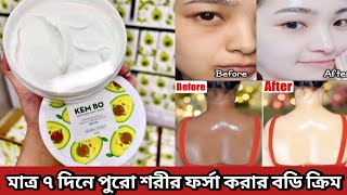 Kembo Whitening Body Cream  Kem Bo Whitening Body Cream Review  Whitening Body Cream [upl. by Sharlene]