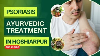 Psoriasis Treatment In Hoshiarpur  Best Psoriasis Specialist Doctor In Hoshiarpur [upl. by Lizned]