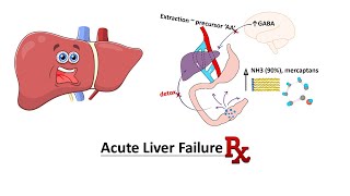 Acute Liver Failure Management [upl. by Eihtak303]