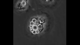 Cryptococcus neoformans Thermotolerance to Avian Body Temperature Is Sufficient For Extracellular [upl. by Ringe]