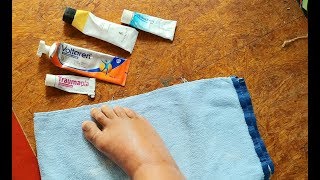 Heilende Salben bei Entzündungen Retterspitz Voltaren Schmerzgel Forte Traumaplant Bebanthen [upl. by Nallad]