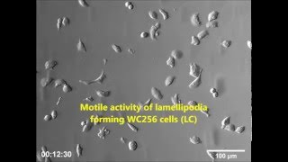 Lamellipodia and Membrane Blebs Drive Efficient Electrotactic Migration of Rat Walker Carcinosarcoma [upl. by Elysha176]