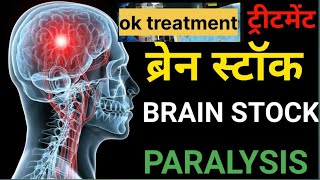 लकवा का ईलाज lakwa treatment paralysis treatment 8381 9546 58 [upl. by Nerra]