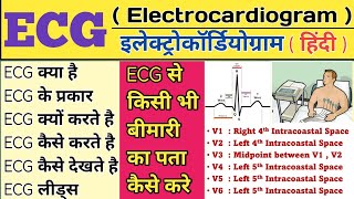 ECG  Electrocardiogram  ECG Test  ECG procedure  ECG Report  ECG Test Normal Report  ECG notes [upl. by Yelloh]