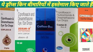 Ciprofloxacin amp dexamethasone eyeear drops  ciplox d drops  zoxan d drops  ceflox dee drops [upl. by Bank]