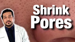 How to Shrink Pores For Good  Get Rid of Pores on Nose FAST 2021 [upl. by Assira]