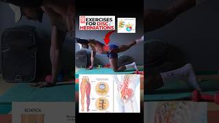 9 Effective herniated disc exercises and stretches herniateddisc herniarepair stretches [upl. by Vilberg187]