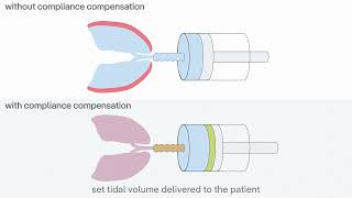 Protective ventilation during pediatric surgery with Atlan anaesthesia workstations [upl. by Meli479]