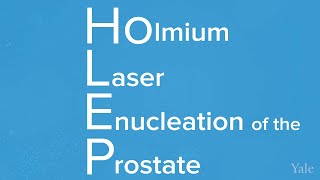 HoLEP Procedure Helps Alleviate BPH [upl. by Yramesor]