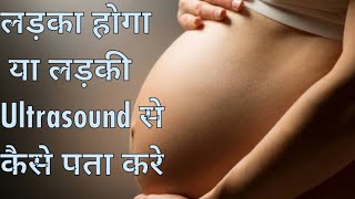 Anterior placenta  Posterior placenta Ultrasound से कैसे पता करे कि बेटा होगा या बेटी।। [upl. by Nesta]