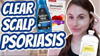 How to CLEAR SCALP PSORIASIS Dr Dray [upl. by Henarat65]