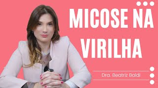 Micose na virilha  Dra Beatriz Franchito Baldi [upl. by Refotsirc]