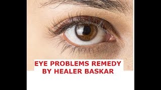 Eye problems Long sight short sight glaucoma remedy by HEALER BASKAR Educational purpose [upl. by Garceau]