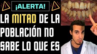 ⚠️¡ALERTA⚠️ La MITAD de la POBLACIÓN no sabe lo que es la PERIODONTITIS [upl. by Adnorrahs]