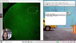 ImageJ  Densitometry using MAX projection image [upl. by O'Malley]