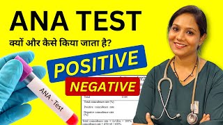 ANA Test क्यों किया जाता है Antinuclear Antibody Test in Hindi [upl. by Holihs]