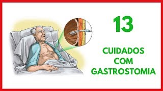 Cuidados de Enfermagem com Gastrostomia [upl. by Stock260]